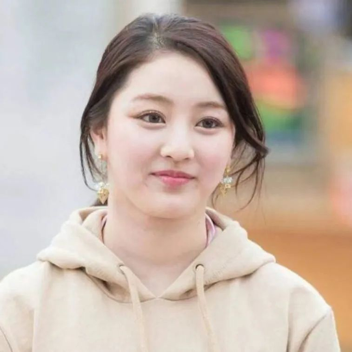 苹果脸则是因为天生苹果肌大,紧贴眼眶,于是睑颊沟被压缩了,也就有了