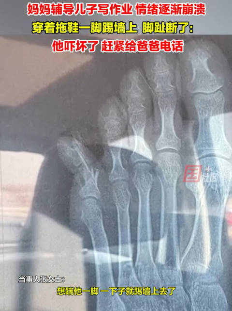 隔着屏幕都疼女子辅导儿子作业情绪崩溃踹断脚趾