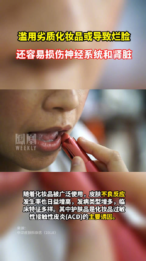 滥用劣质化妆品后果不只是烂脸还容易损伤神经系统和肾脏