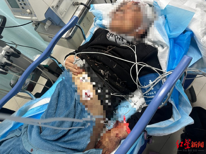 ▲郭先生在病房接受治疗 受访者供图