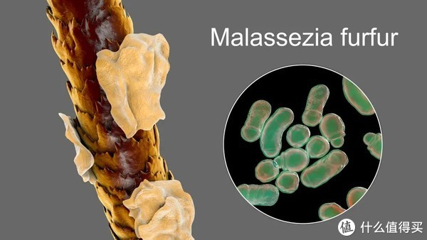 去屑高手酮康唑洗剂怎么用