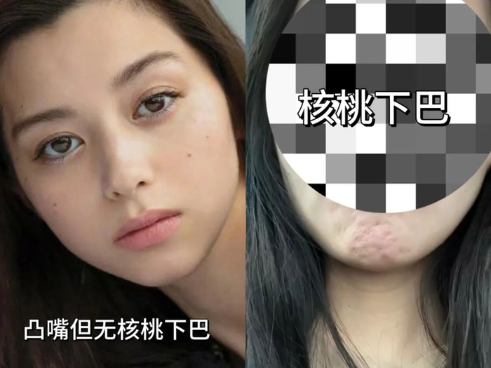16615看侧脸,眉心,鼻下点,下巴尖几乎在一条直线上,且鼻尖,嘴唇