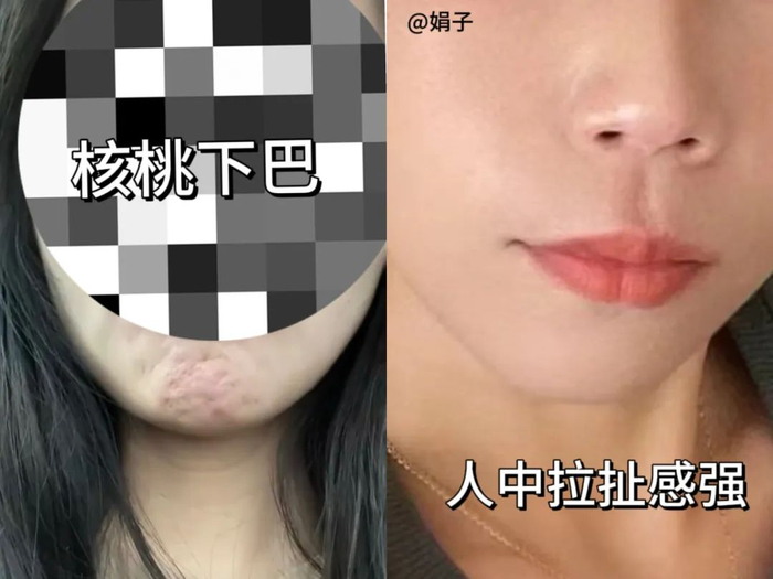 综艺用力过猛竟都没人接腔…|李菲儿_新浪新闻
