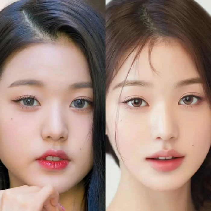 改动很简单,只要加宽口裂,修饰唇形,让唇周软组织不挤压在牙齿周围就