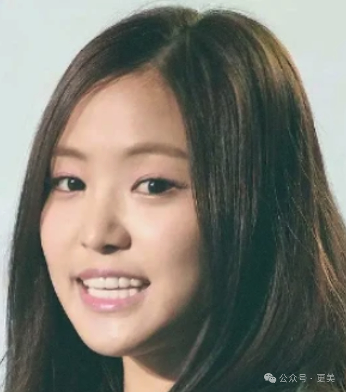 为啥垫完鼻基底后,她人中像被电熨斗烫平了一样…|孙娜恩_新浪新闻