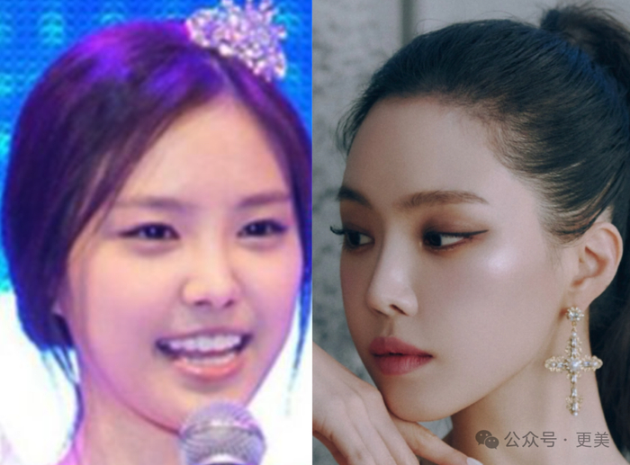 他又着眼于面中一枝花的鼻子,把1·0版不太高挺的鼻子加高,鼻尖加 ..