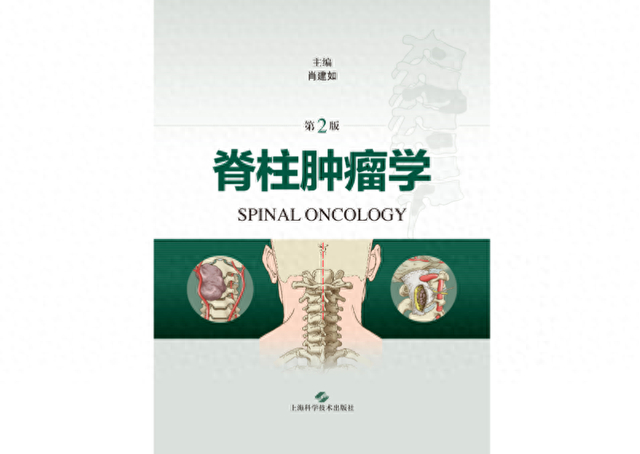 学术书架脊柱肿瘤学再版聚焦各类脊柱肿瘤的诊断治疗