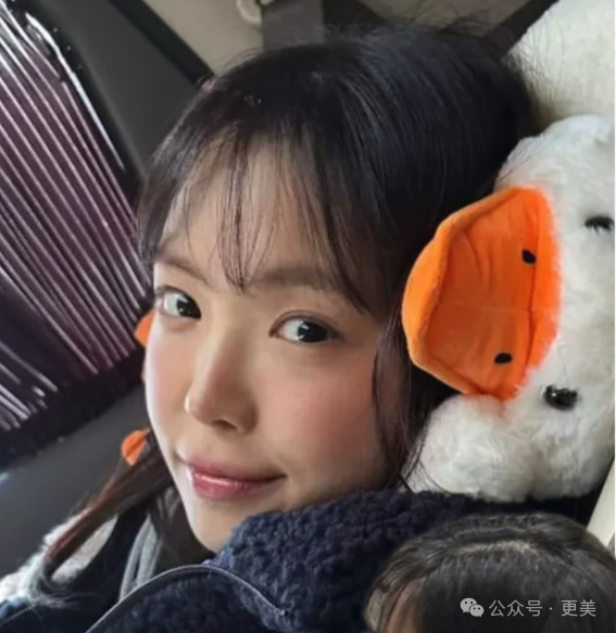 为啥垫完鼻基底后,她人中像被电熨斗烫平了一样…|孙娜恩_新浪新闻