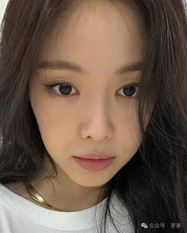 为啥垫完鼻基底后,她人中像被电熨斗烫平了一样…|孙娜恩_新浪新闻