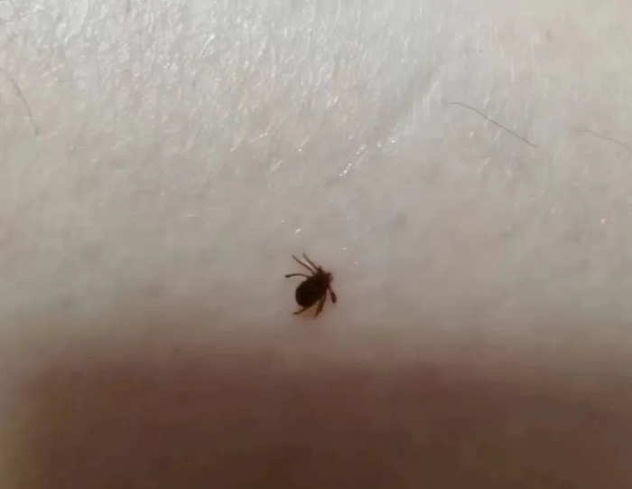 男子扫墓后进了医院!医生提醒