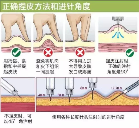 在除此之外的腹部注射时,针头容易扎到肌肉,因为皮下层越往身体两侧越