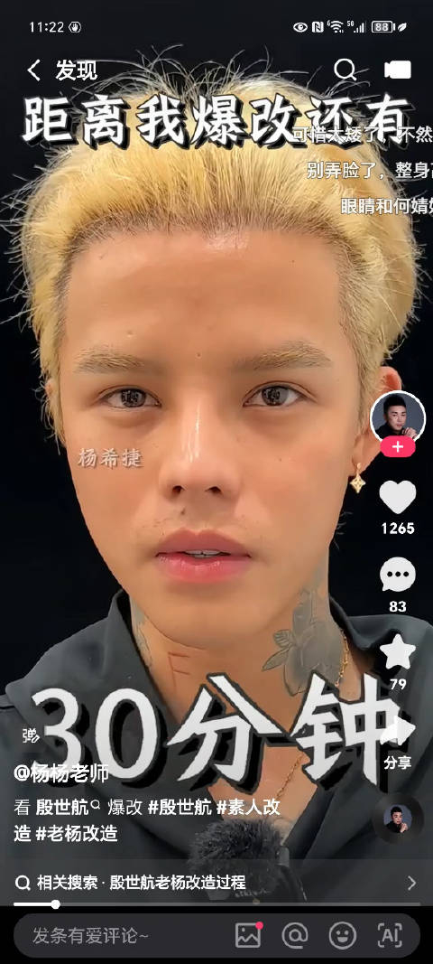 网红殷世航做整容项目做的还不少