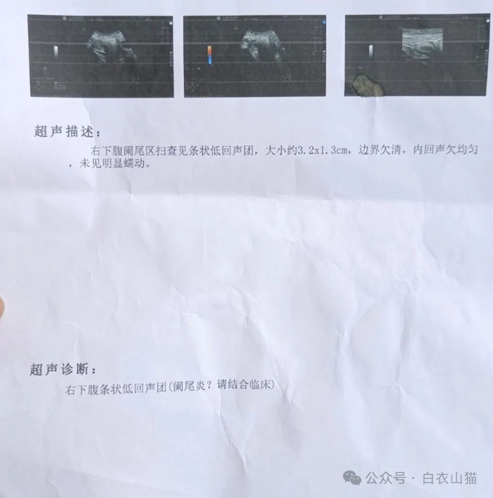 阑尾炎|阑尾|b超_新浪新闻