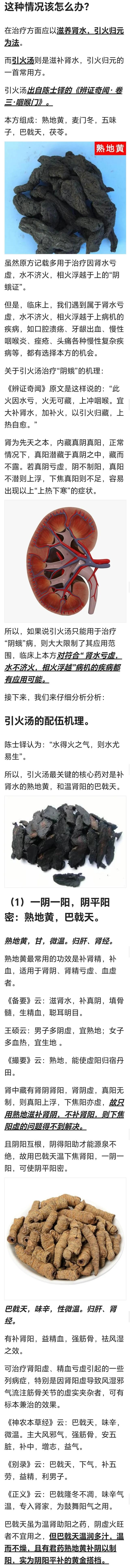 "上有虚热,下有真寒"的上热下寒证,常用陈士铎的引火汤_新浪新闻