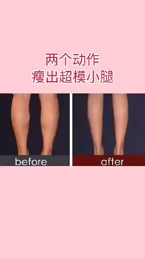 小腿粗壮显的下半身又粗又短两个动作教你快速消除肌肉小腿化身细长直