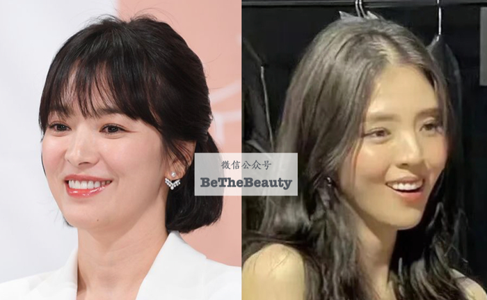 发育健康,脸虽然带点方,嘴没有凸感,所以唇周肌肉放松,做表情也很舒展