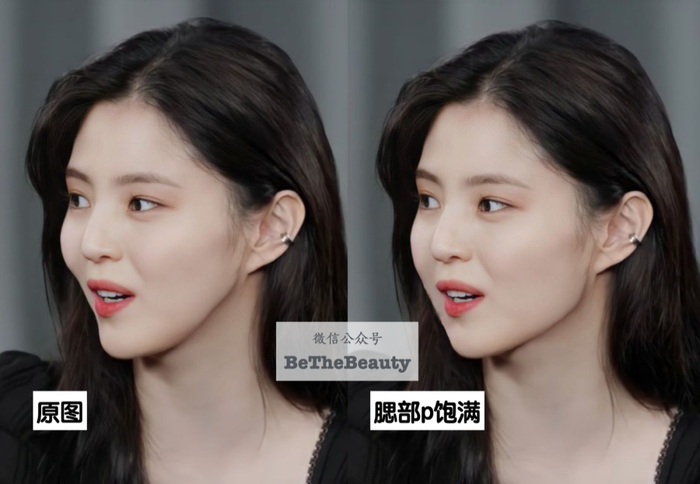 把腮p回来是不是感觉顺眼很多▲所以她侧面照很多都挡下颌线大众