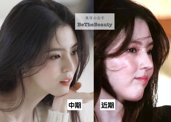 跟秀智对比,两人鼻子高度差不多,但韩依然有瘪进去的感觉鼻基底凹陷