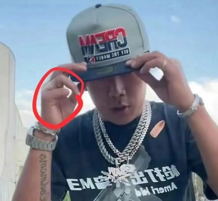 诺米打工时出现意外（图源：微博）