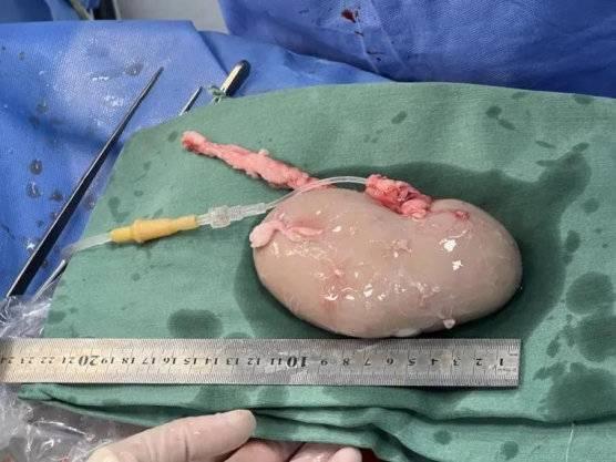 經過基因編輯後的豬腎(圖片源自中國科學報微信公眾號)