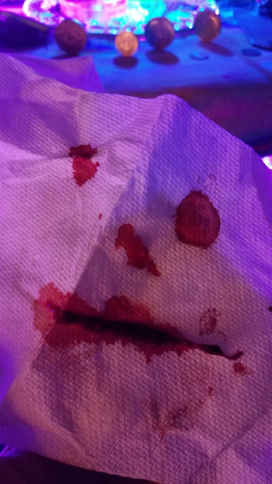 早,鼻出血的博主无意中在纸巾上擦出了一个小丑的面孔|鼻出血|纸巾