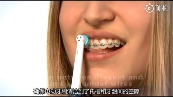 你的电动牙刷用对了吗戴牙套期间怎么刷才能更有效的祛除牙齿污垢呢