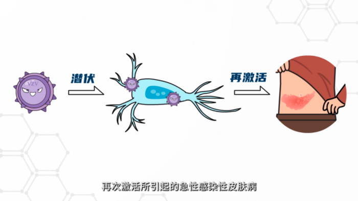 预防"蛇缠腰"的疫苗开约啦!南昌人抓紧!|新冠肺炎_新浪新闻