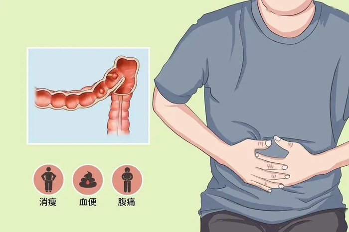 广州居民最新癌症数据排第一的是它这些人可免费查癌