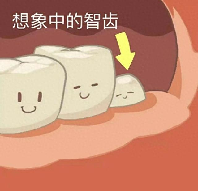 你知道在你嘴里的哪些智齿无法挽留的住吗?