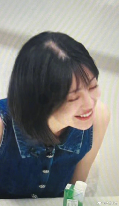 一开始还以为李溪芮这个发缝是灯光或者滤镜的原因,原来是真秃啊