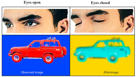 闭眼能看到视后像（图片来源：Salari et al, 2017）