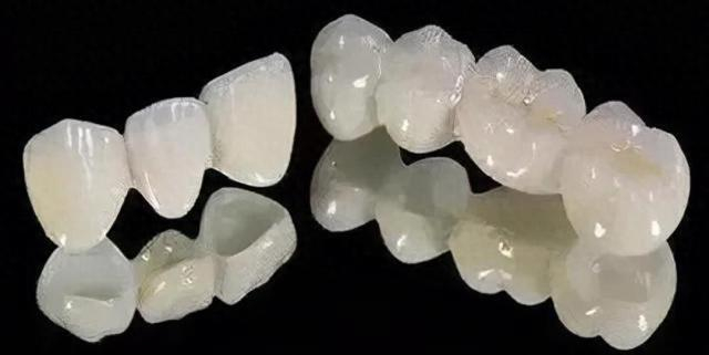 烤瓷冠具体是什么?