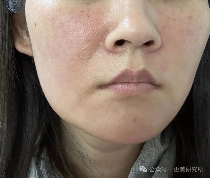 压个宝,这个o型腿的婴儿肌小花绝对会爆!