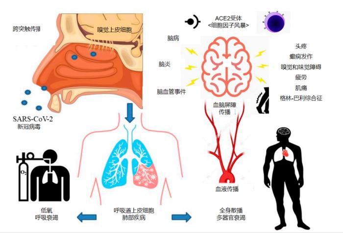 心脏贫血性梗死图片