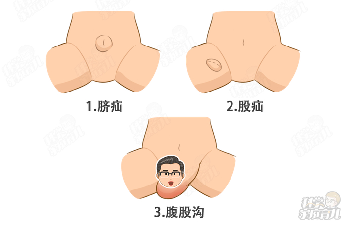 这个能要命的病,千万别存侥幸心理!