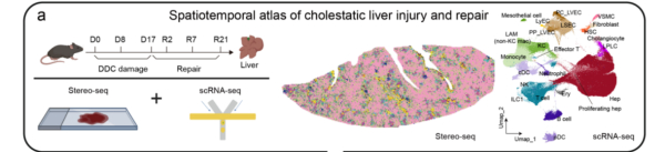 肝脏损伤和修复过程中的时空组学图谱。受访者供图