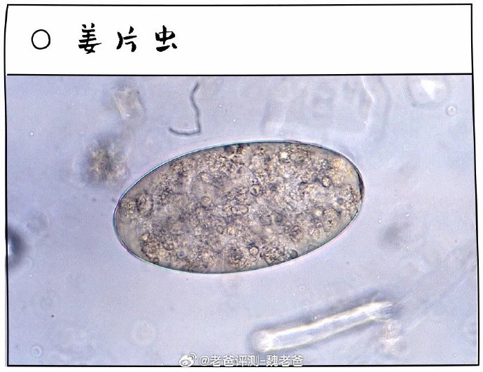 荸荠,又叫马蹄, 它生长于水田之中,生长环境十分潮湿…|寄生虫_新浪
