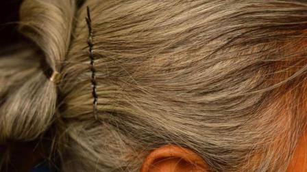 有人说,50岁后,头发越秃寿命越短?这种说法的可信度到底高不高