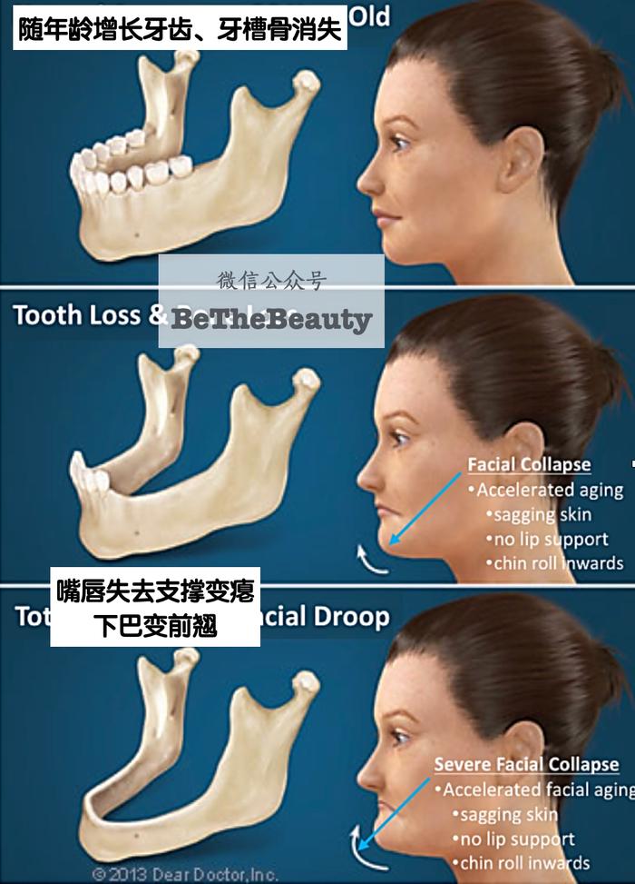 面部骨骼衰老图图片