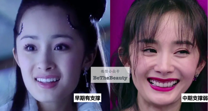 杨幂vs刘亦菲:科技派vs天然派,谁易回春?越努力上镜越易老,你还在学?