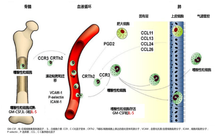嗜酸性粒细胞升高是重度哮喘的"罪魁祸首"