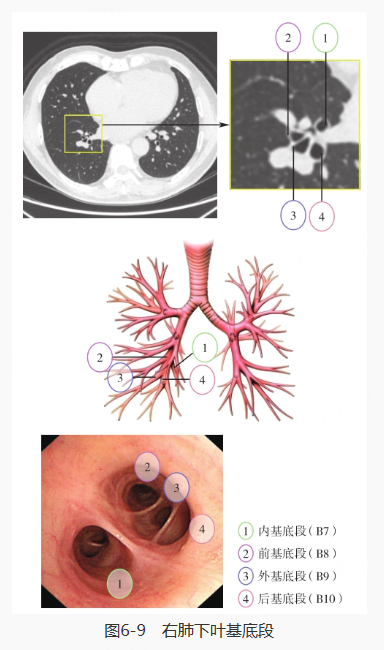 左肺上叶尖后段·前段,左肺上叶上舌段·下舌段,左肺下叶,左肺下叶背