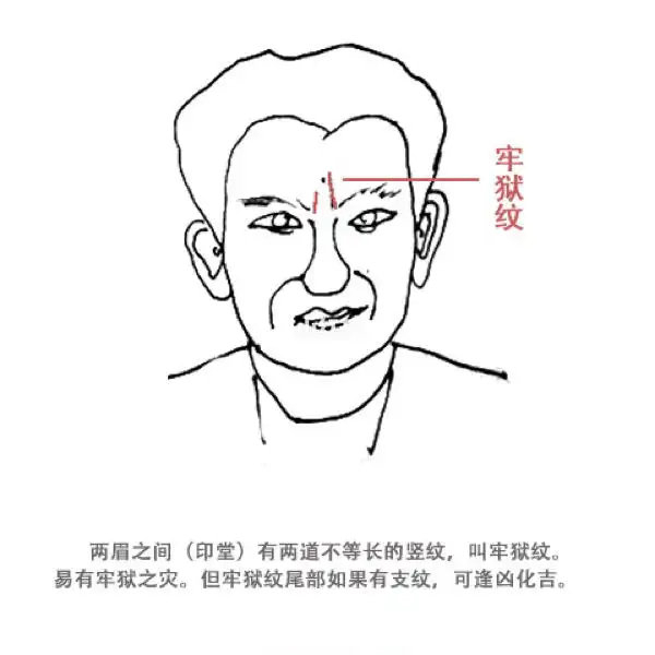 图一为牢狱纹, 牢狱纹一般是靠近眉头位置的斜纹
