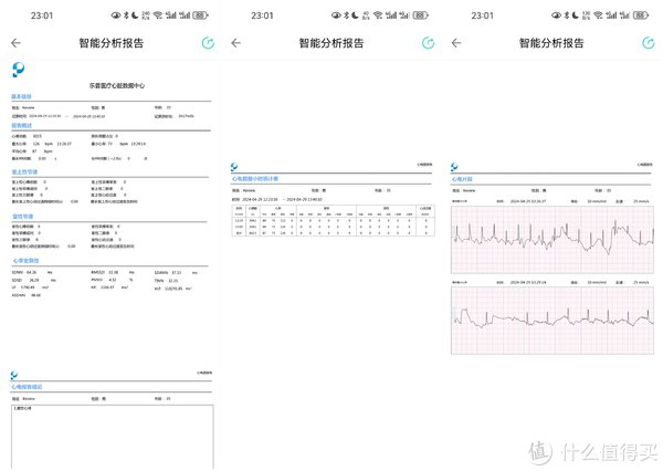 心电产品有哪些心脏问题不容忽视，家用心电产品怎么选？_https://www.jmylbn.com_新闻资讯_第9张