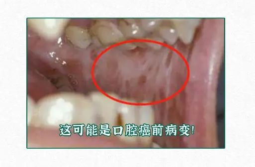 抽烟喝酒还嚼槟榔,到底tm死得有多快?