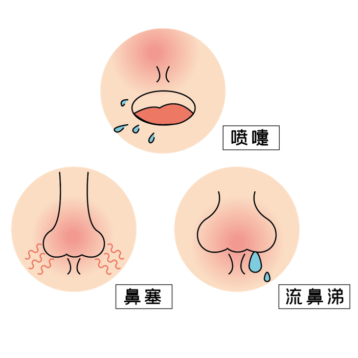 原因和应对方法看过来 | 科普时间|鼻塞|鼻腔|手术_新浪新闻