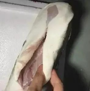 图源：深圳卫健委