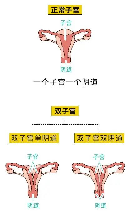 派不上用场第二根发育异常都比较惨但大部分畸形的人可以轮流或同时排