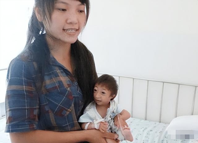 15年前湖南夫妇生了个"小猴子",马戏团想5万买下,现在怎样了