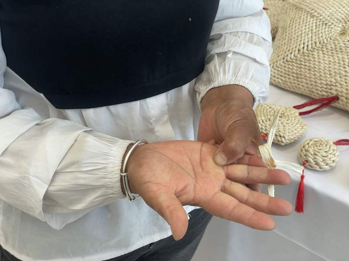 张林秀的手上有不少厚茧。新京报记者 陈超 摄